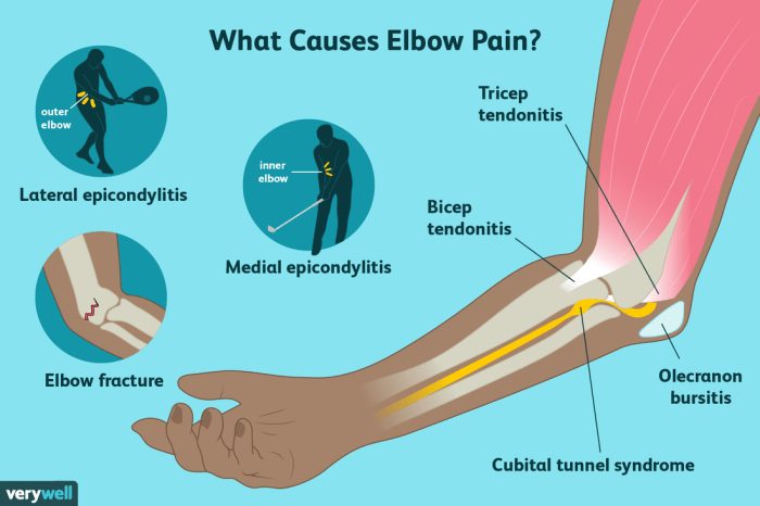 A eduardo le duele el codo. knee leg elbow neck